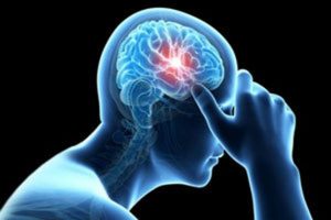 آشنایی با علل بروز سکته مغزی