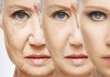 روش های رفع چین و چروک پوست صورت