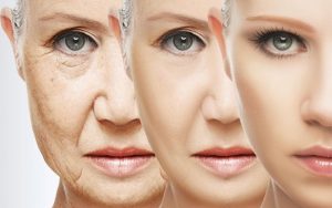 روش های رفع چین و چروک پوست صورت
