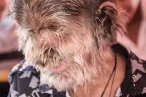 عجیب ترین سندروم های دنیا