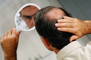 خوراکی های ضد ریزش مو