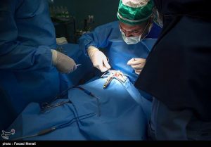 خارج کردن توده بزرگ از بدن نوزاد ۲ کیلویی در کرج