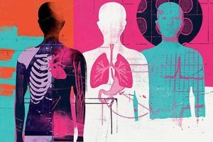 چند بیماری که با ام اس اشتباه گرفته می‌شود