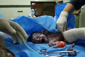 نیمی از زایمان های البرز، افغانی شد!