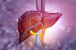 کبد چرب چیست و چه علامتی دارد؟