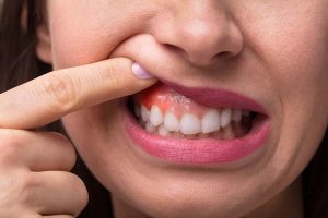 اصلی ترین دلیل مرگبار شدن ویروس کرونا کشف شد