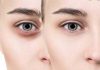 راهکارهای طبیعی برای برطرف کردن تیرگی دور چشم
