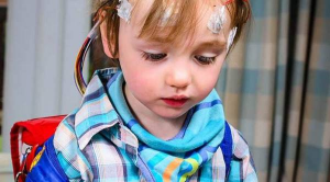 صرع در کودکان چه نشانه هایی دارد؟