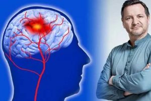 راهکارهای موثر برای جلوگیری از سکته مغزی