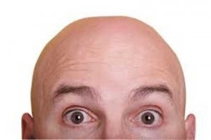 چرا مردان طاس بیشتر در معرض کرونا قرار مى‌گیرند؟