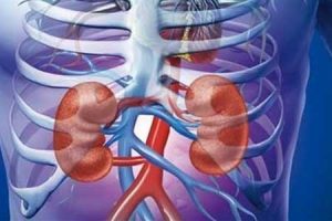 فیبروز کلیه چیست؟