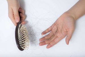 رایج ترین علل علمی ریزش مو