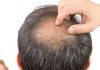 تفاوت ضایعات پوستی ناشی از کرونا با سایر عوارض پوستی