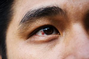 بیماری هایی که علائم آن در چشم‌ ظاهر می‌شوند