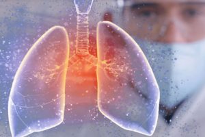آیا ممکن است ریه ها بدون علائم درگیر کرونا شوند؟