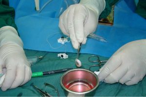 بانک چشم در بهشت سکینه (س) کرج راه اندازی می شود