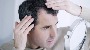 درمان سفیدی و ریزش مو با چند ترفند ساده در منزل