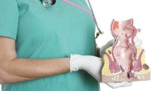 همه آنچه باید درباره هموروئید یا بواسیر بدانید؛ چه کنیم به این بیماری دچار نشویم