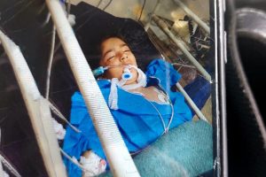 جان باختن متینای ۸ ساله زیر کتک های ناپدری | اعضای بدن این دختر اهدا شد