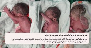 مادری پس از ۸ سال نازایی، سه قلو به دنیا آورد + عکس
